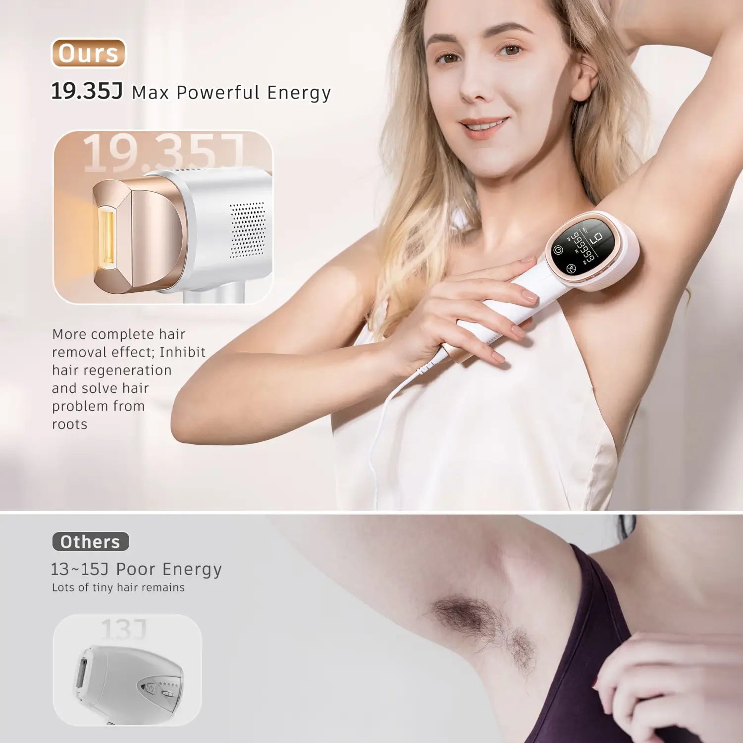 Aminzer ipl laser hair removal 999,999 flashes 3 in 1 epilator - laser hair removal